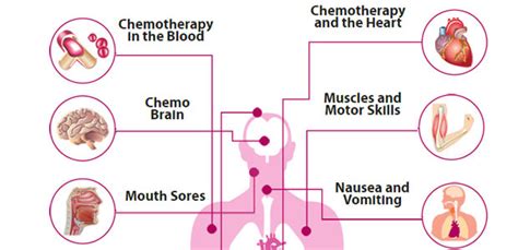 Chemotherapy – Pertubuhan Pencegahan Kanser Pulau Pinang