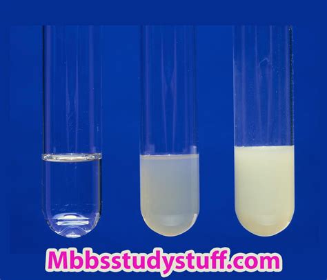 Protein Precipitation tests - Medical Study Zone