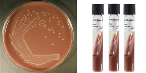 Chocolate Agar Media - Principle, Composition, Preparation, Result ...