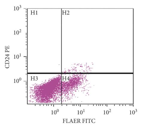 PNH flow cytometry. Lymphocytes (red), monocytes (green), and ...