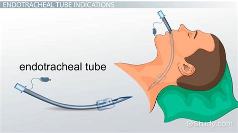 Endotracheal Tube In Patient