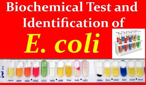 Biochemical Test and Identification of E. coli