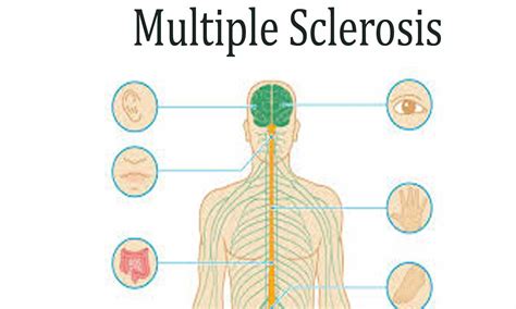 Multiple sclerosis skin lesions: Understanding Multiple Sclerosis (MS ...