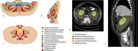 Retroperitoneal Diagram