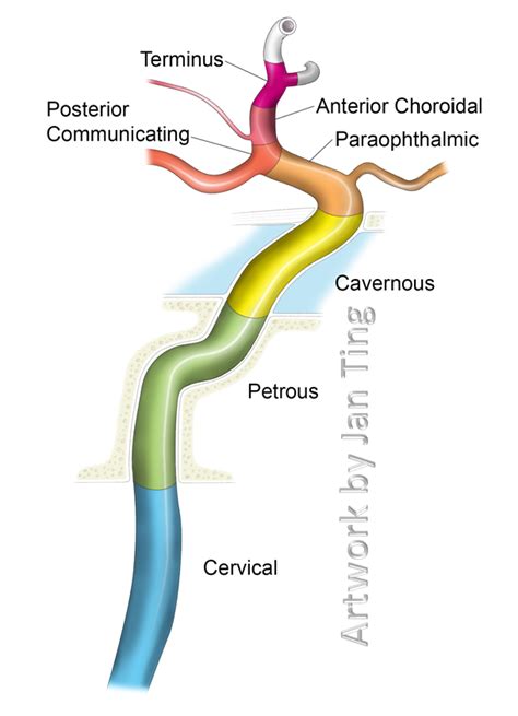 branches of ica by atlas anatomy - Google Search | Internal carotid ...