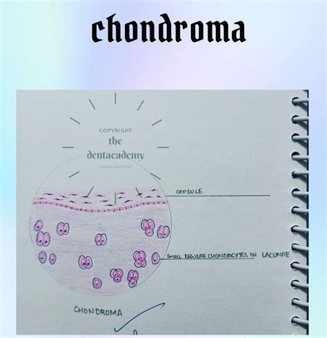 Chondroma | Pathology, Capsule, Medical