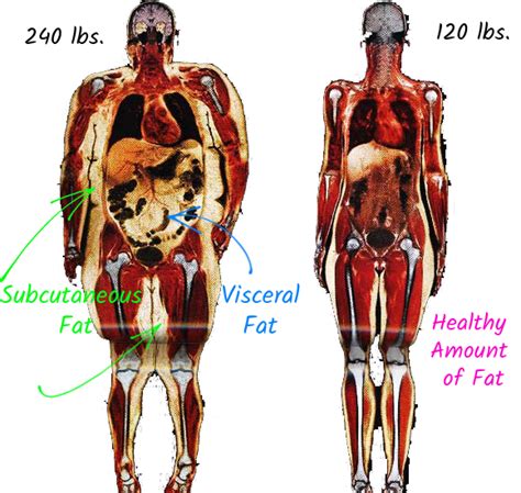 XRay Body Fat - Skin by Design Dermatology & Laser Center, PA