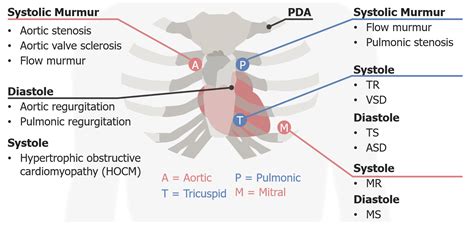 Heart Sounds | Concise Medical Knowledge