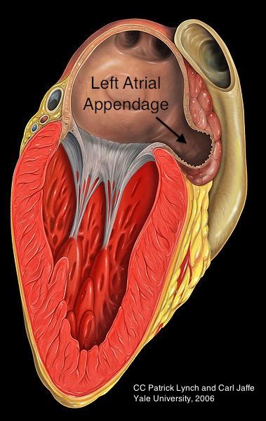 经食管超声心动图(transesophageal echocardiography,tee),心脏ct及 - 动态图库网