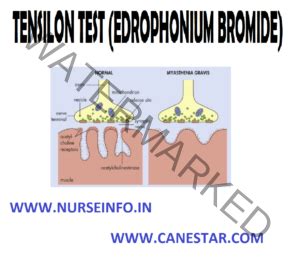 TENSILON TEST (EDROPHONIUM BROMIDE) - Nurse Info