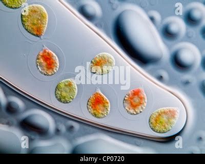 Haematococcus pluvialis (Haematococcus pluvialis), in differential ...