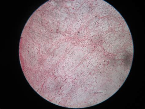 Loose areolar connective tissue – howMed