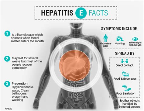 What is Hepatitis A & E | Best Liver Transplant in India