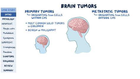 Pediatric brain tumors: Pathology review: Video | Osmosis