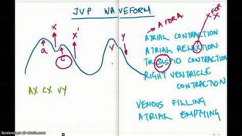 EASY WAYS TO REMEMBER JVP WAVEFORM | Doovi