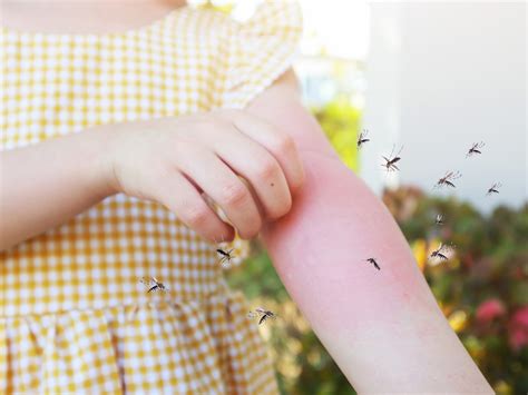 Why Mosquito Bites Itch – Mosquito Shield