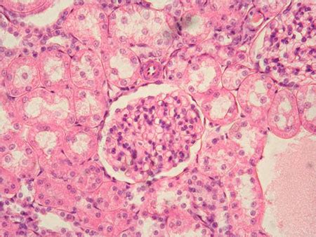 Simple squamous epithelium