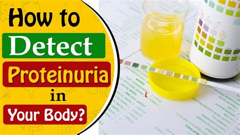 What is Proteinuria and How to detect it ? | Kidney Expert and ...