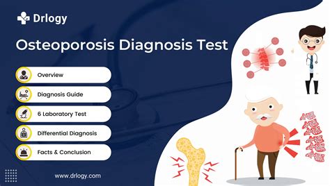 6 Accurate Test For Osteoporosis Diagnosis in Early Detection - Drlogy