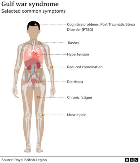 Sarin gas blamed for Gulf War syndrome