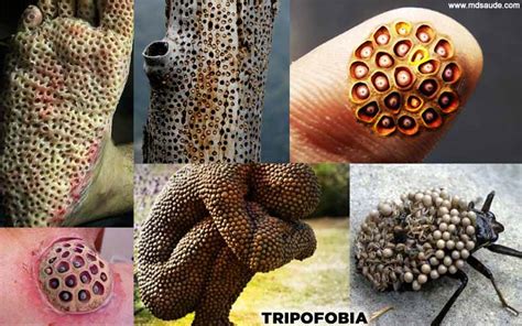 Trypophobia Disease Causes