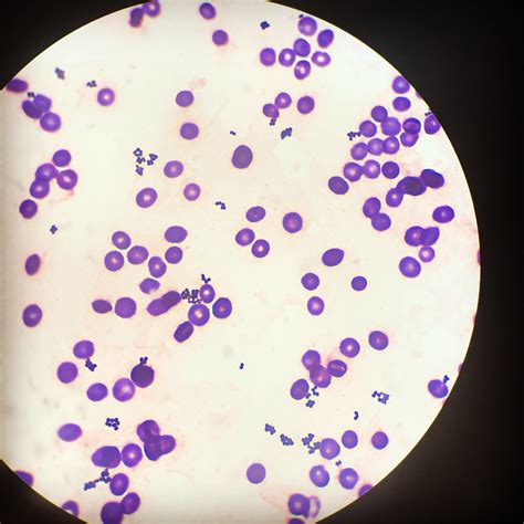 Gram positive cocci in clusters, seen under 100x. : r/medlabprofessionals