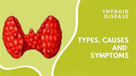 Thyroid Disease: Types, Causes and Symptoms