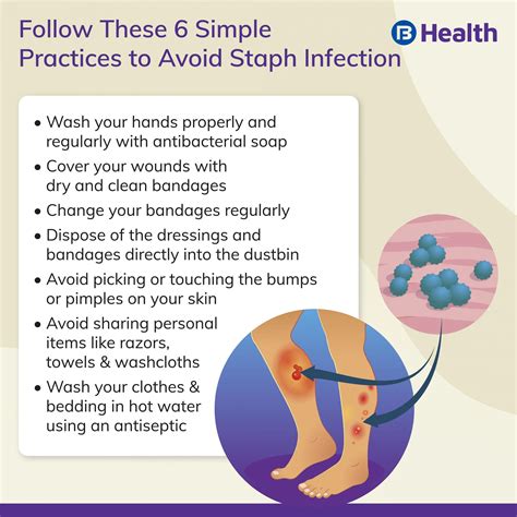 How To Prevent Staph Infection - Ask The Nurse Expert