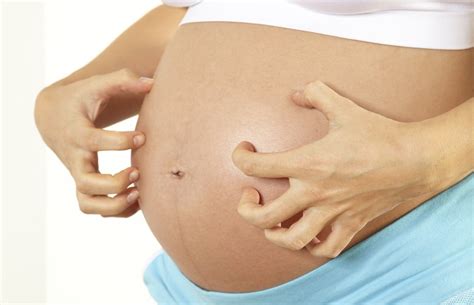 Learn About Itchy Skin During Pregnancy - Huggies