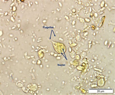 Giardia Trophozoites Images Under Microscope