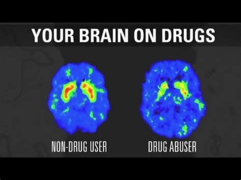 How addiction changes your brain - YouTube