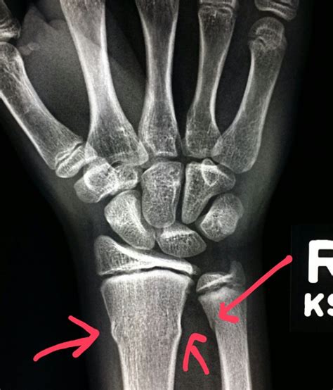 Pin on Unusual X-rays