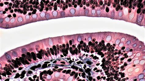 Mammalian Histology: Epithelial Tissues – Berkshire Community College ...