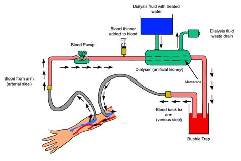 haemodialysis – Liberal Dictionary