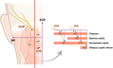 The depth of emergences of the greater occipital nerve (GON) and third ...