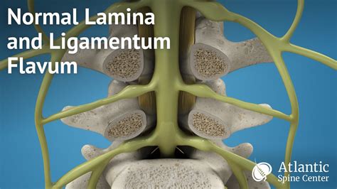 Ligamentum Flavum Mri Anatomy - Human Anatomy