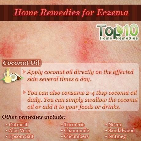 Home Remedies for Eczema | Top 10 Home Remedies