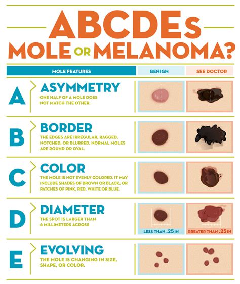 Abcde Rule Of Skin Cancer Detection