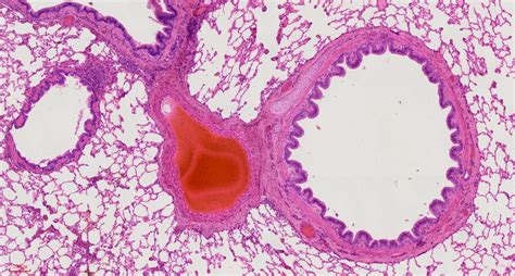 Human lung section histology slides, 7 µm sec., H&E Stain, human ...