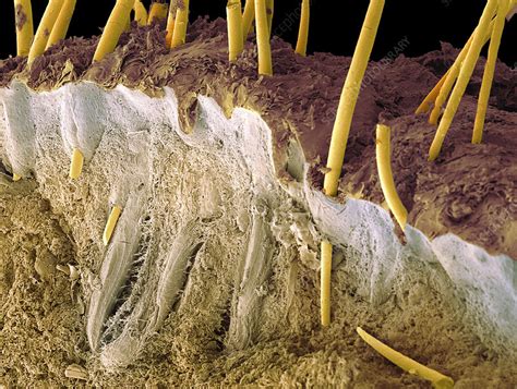 Hedgehog skin and spines, SEM - Stock Image - Z904/0060 - Science Photo ...