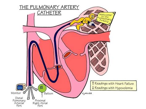 This Nursing Student Can't Even: Day 9: HEMODYNAMIC MONITORING