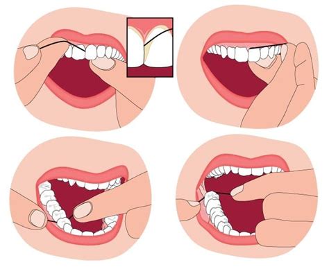 Common Flossing Mistakes - Magnolia Dental