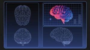 Focused Ultrasound to Treat Parkinson’s | APDA