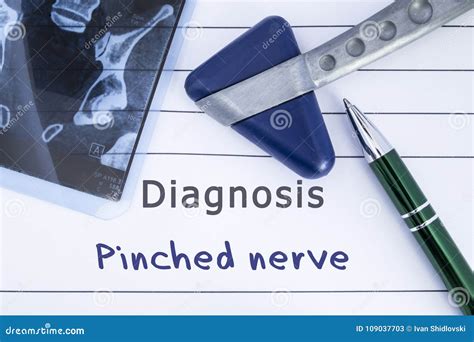 Diagnosis of Pinched Nerve. Medical Health History Written with ...