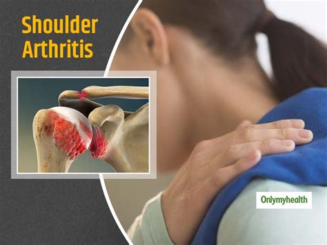 Shoulder Arthritis: What Happens In Shoulder Arthritis And Tips To ...