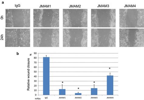 Wound-healing assays. a Representative images of wound closure assays ...