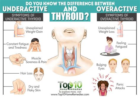 Symptoms Of Overactive Thyroid Problems