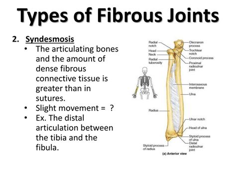 PPT - Joints PowerPoint Presentation, free download - ID:2034256