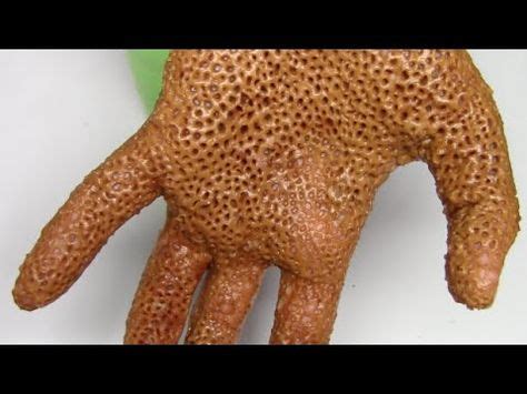 Trypophobia Skin Disease Bug