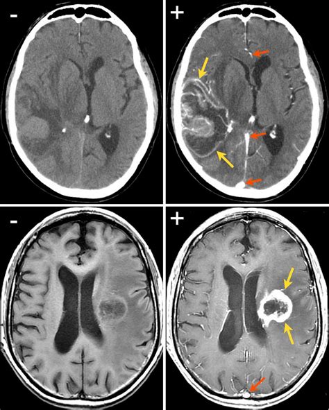 HEALTH FROM TRUSTED SOURCES: Brain : CT MRI